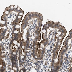 MMRN2 Antibody, Novus Biologicals:Antibodies:Primary Antibodies